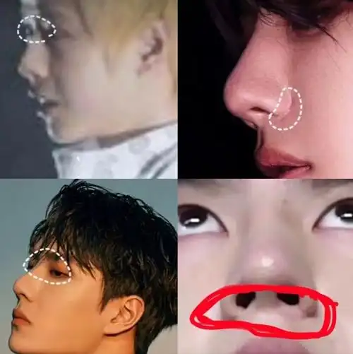 王一博脸塌了越来越僵真假,他的脸部变化对比图