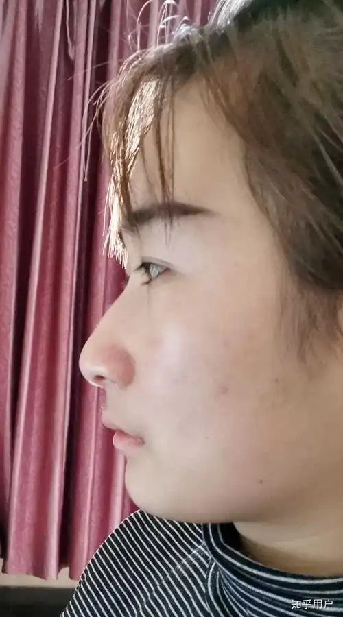 侧脸暴丑怎么办…还有救么…有图?