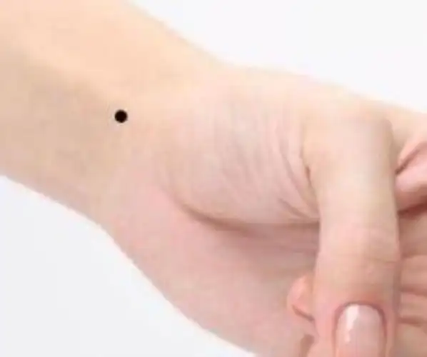 手上痣相图解(手上各部位痣相命理解析)