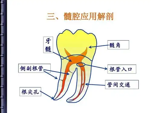 三,髓腔应用解剖 牙 髓 侧副根管 髓角 根管入口 管间交通 根尖孔