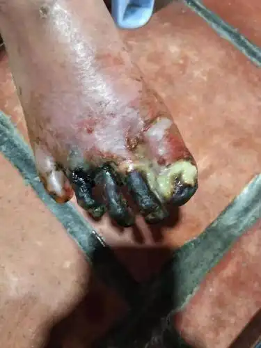 的三月份就开始到现在一直都在用药,但是没找到,更好的药可以帮他治疗