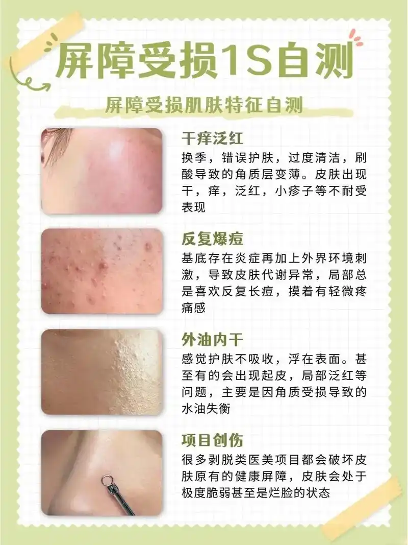 屏障受损大揭秘!快来自测一下!姐妹们,有没有感觉到最近肌肤状 - 抖音