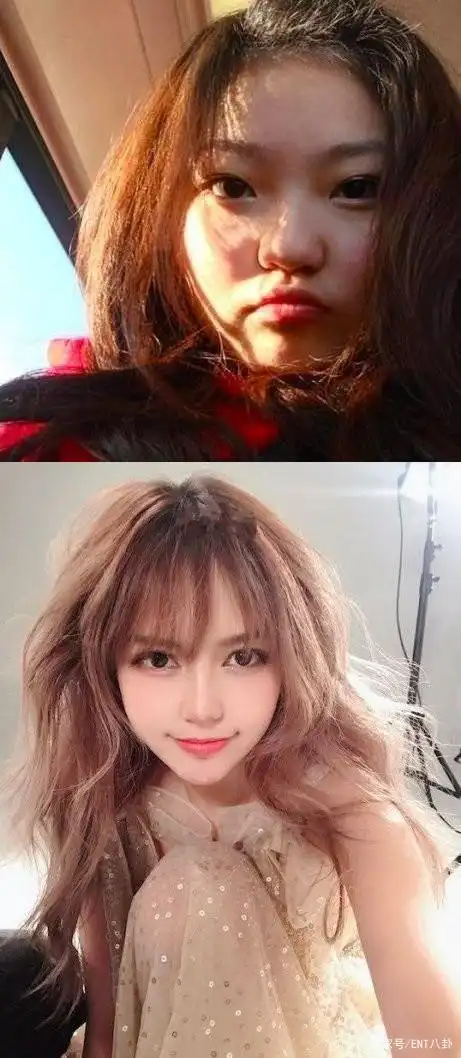 周扬青前后整容对比照,现在很漂亮,很有混血范儿特别那双大眼睛