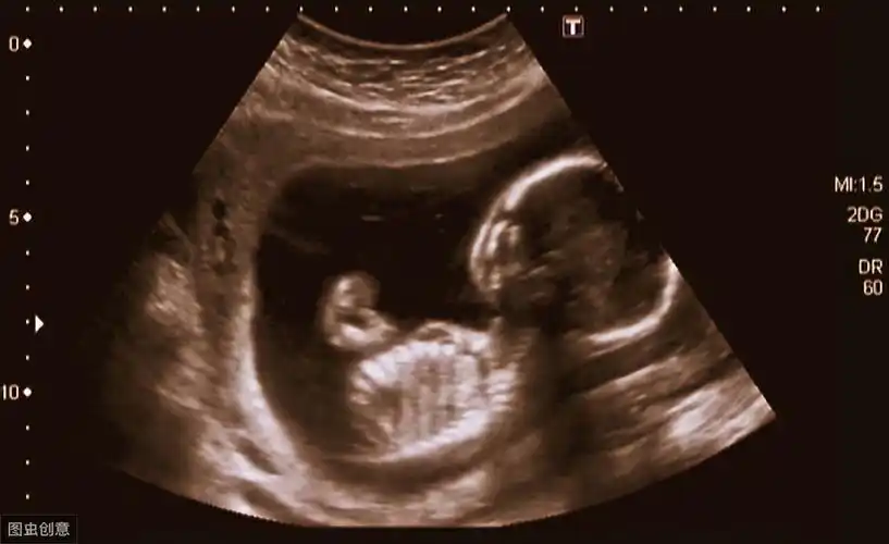 四个月的胎儿是什么样子图片(怀孕四个月的胎儿有多大,发育成什么样儿