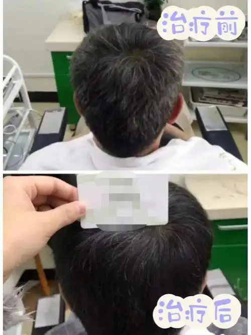 白发转黑大叔变型男改变在颐扬开始