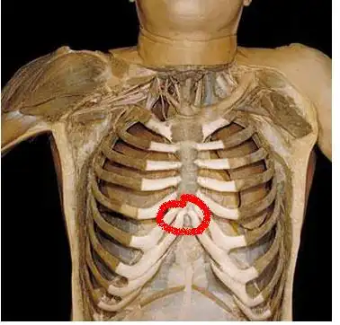 胸口中间疼是怎么回事?不经常_百度知道