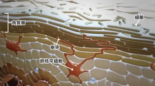 哪里皮肤是角质 哪种情况该去角质 去角质的方法_细胞层