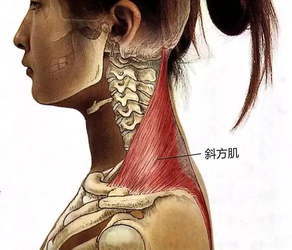 斜方肌紧张,颈后大包,上交叉综合征,造成虎背熊腰的原因都在这了!