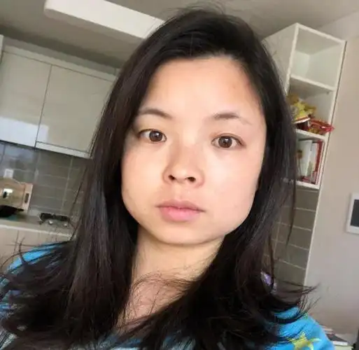 不同脸型适合什么鼻型(被公认的丑鼻型)(11)