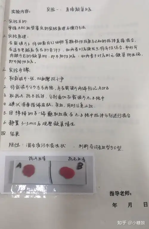 医学免疫学实验报告1直接凝集反应