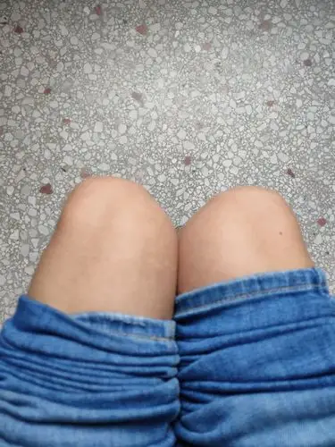 坐的时候,膝盖朝外,请问是膝外翻吗?可我是o型腿呀