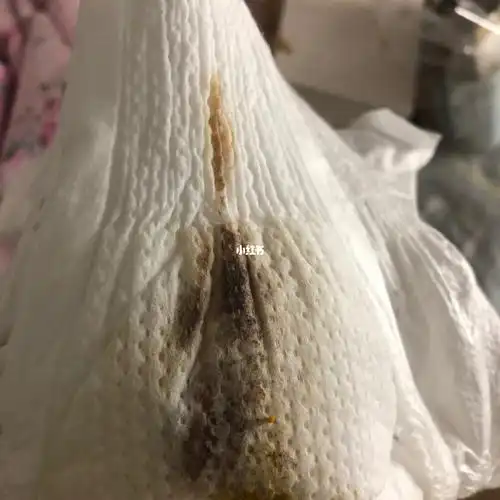 宝宝尿不湿出现褐色的东西怎么办?什么原因造成的?