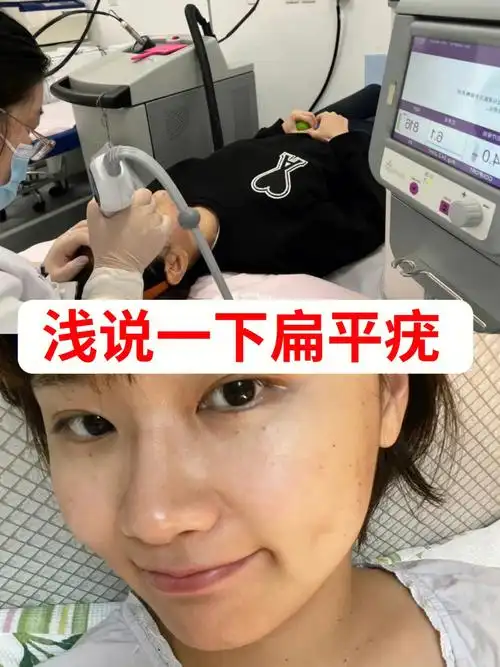 跟风入的扁平疣!需要我踢你吗?