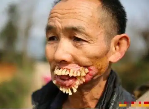 全世界长相最恐怖的人,一个比一个怪异,看到第四个就吐了!