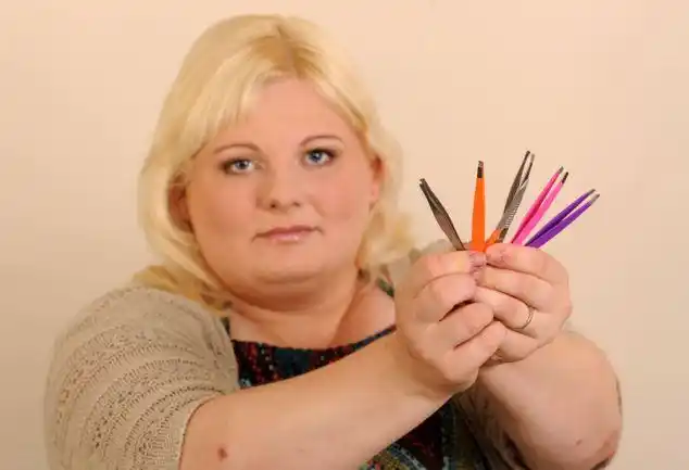 英女子患罕见病拔汗毛成瘾组图