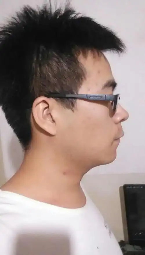 我的嘴巴有点突,侧脸和45度角斜侧脸不好看.