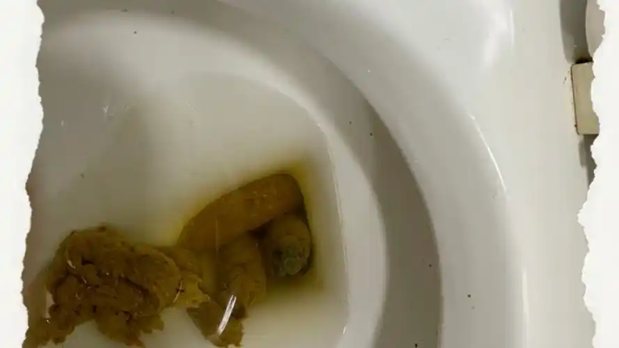 太恶心了 拍的宝宝粑粑