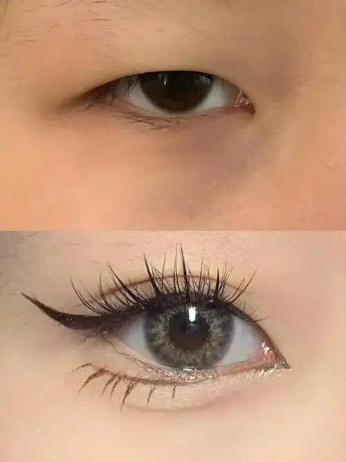 单眼皮肿眼泡双眼皮贴手把手教程新手进