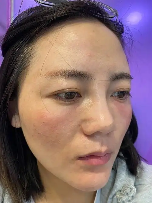 打泪沟的第一天