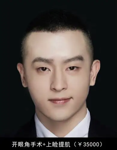 普通人靠它竟能秒变帅哥?