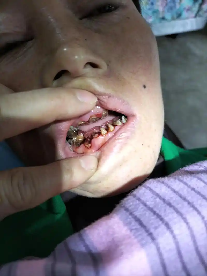 刷脸的社会,如果没有一口洁白无瑕漂亮的牙齿,再年轻也是老奶, - 抖音