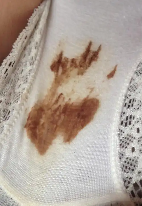 这是着床出血吗?别嫌恶心的进