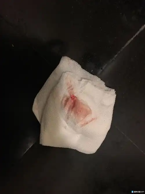 [试管婴儿]怀孕24天有明显少量红色的血轻