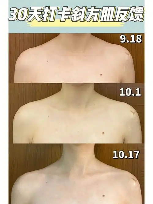 斜方肌真的真的可以改善6015坚持超酷的90