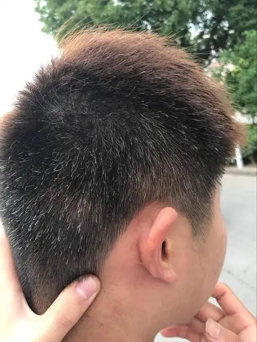 白发长得太快每月补染,每个月补染一次白发有无伤害