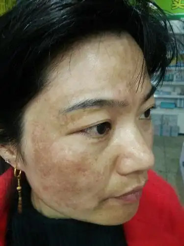 淮阳新站天姿名妆黄褐斑顾客 - 美篇