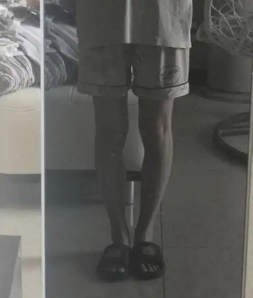 跷二郎腿导致的腿弯真的谢