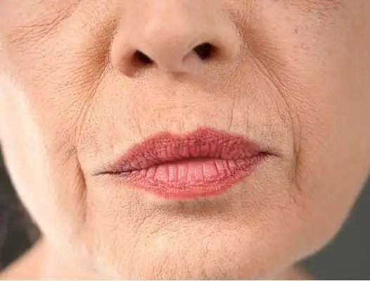 皮肤松弛怎么办效果惊人的祛皱秘籍揭秘
