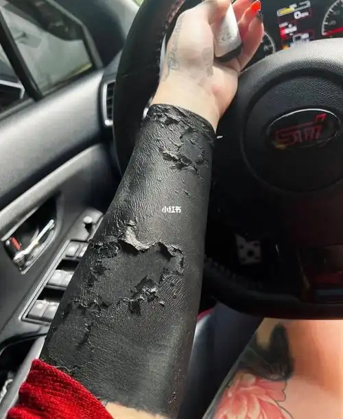 黑臂恢复过程冷门纹身