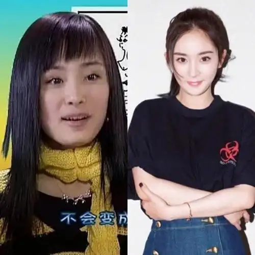 杨幂拔牙后遗症犯了打脸说整容的人粉丝这毛病可以接受