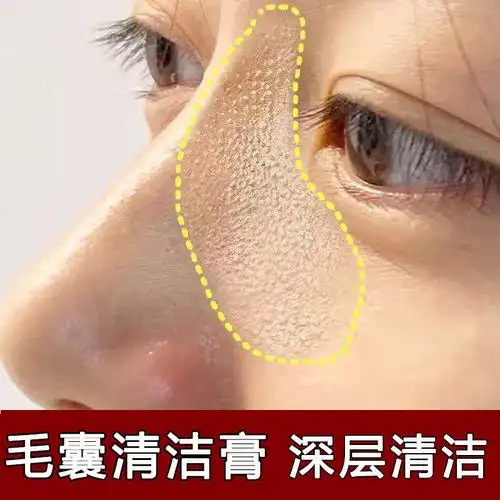 美容院毛囊清洁霜去黑头粉刺闭口角质清洁疏通净化毛孔面部按摩膏