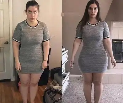 这是她在减肥期间的170斤和反弹期间的160斤的对比图,不同的肥胖,呈现