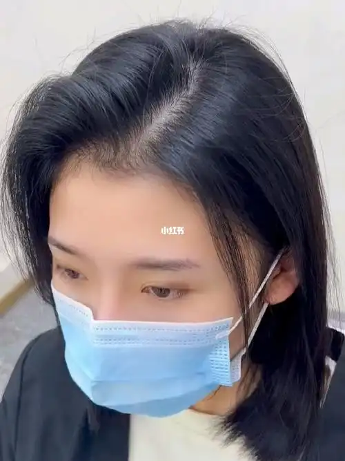 头顶蓬松摩根烫