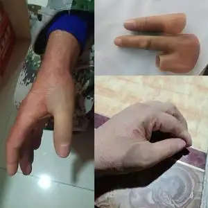 防护进口硅胶手指假肢美容手套仿真脚趾套美甲半指残疾人逼真义肢