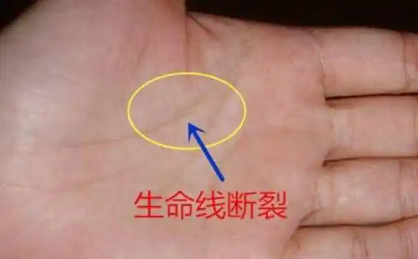 但若以线之长度来决定是否短命是危险的;如左右手的生命线均短,且几乎