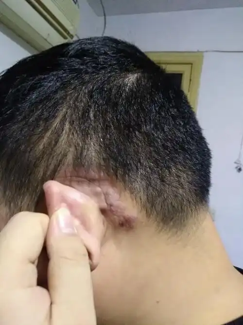 大家帮我看看耳朵后面长了什么