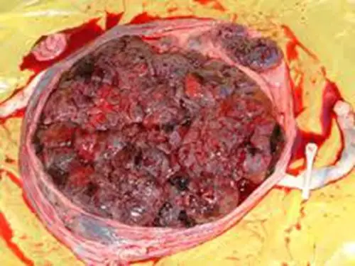 人胎盘详细的特征图片