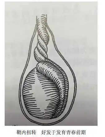 11岁儿子总撅屁股走路爸爸脱他裤子吓傻医生叹保不住