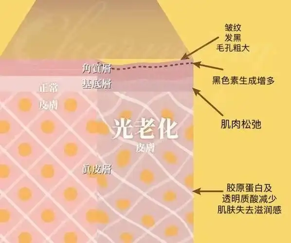 怎么缓解皮肤老化?