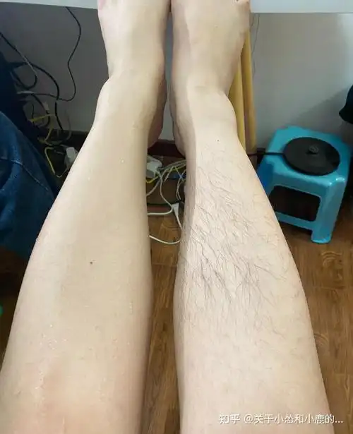 女生汗毛重是怎样的一种体验? - 知乎