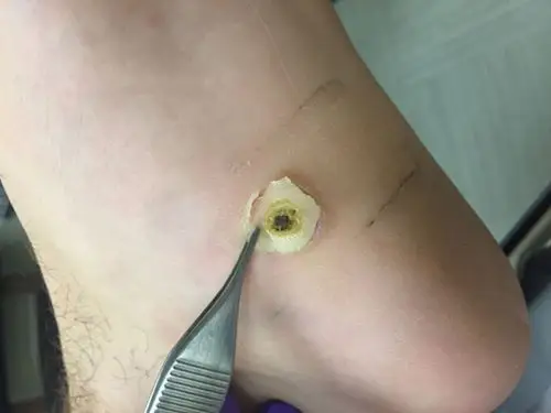 刺猴初期各种图片50