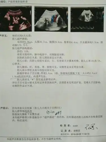 有胎盘血窦的孕妈吗?