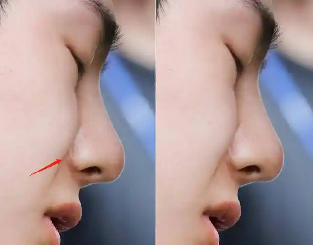 王一博,真的别演了!整容痕迹在镜头下被曝光无数次_鼻子_鼻梁_网友