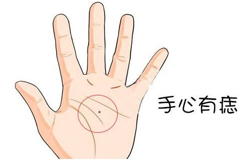 痣相算命:手上有这几颗痣的人,富贵长寿福气多,你有吗?