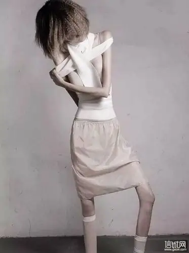 已经瘦成枯骨的女孩,抑郁缠身仍在节食