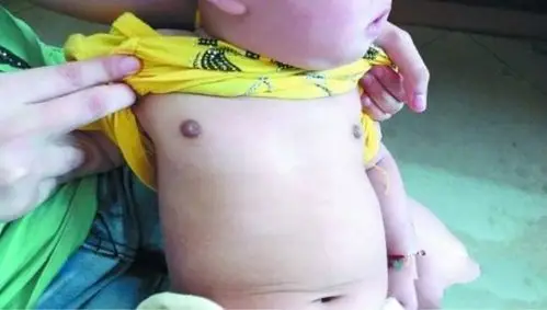 7岁女孩"性早熟",只因为奶奶平时的一句"多吃点!